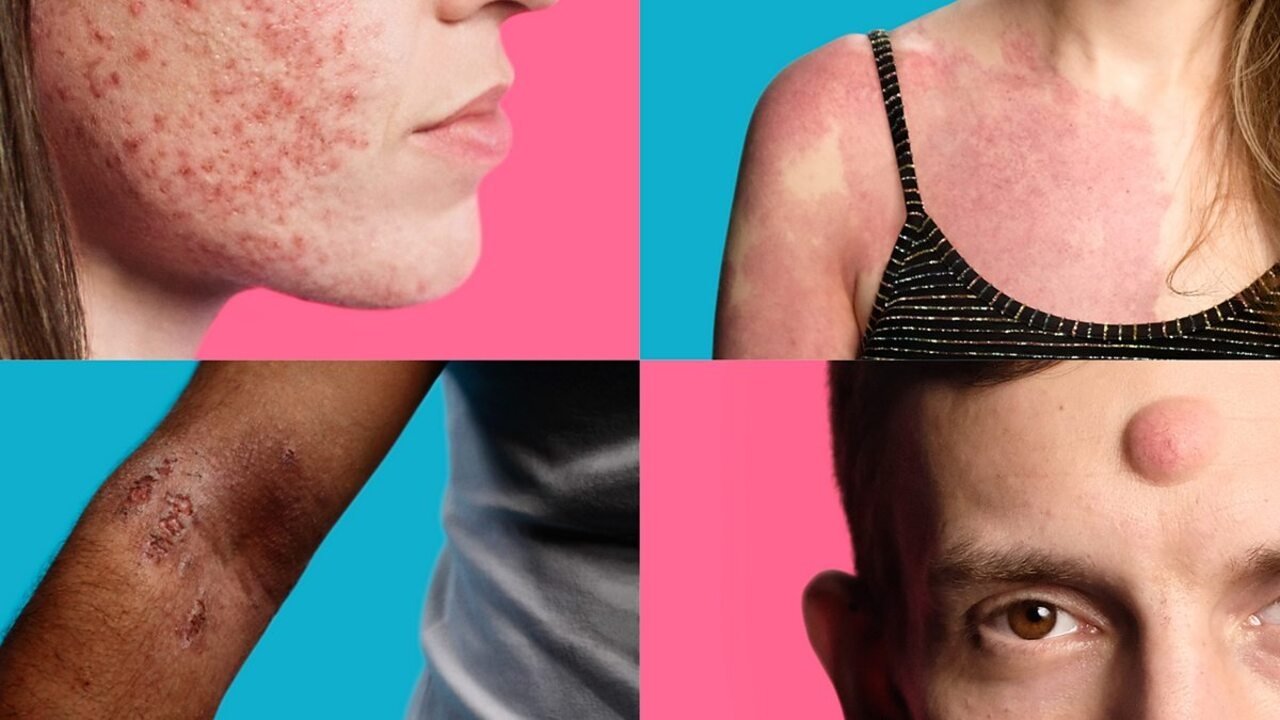 Skin