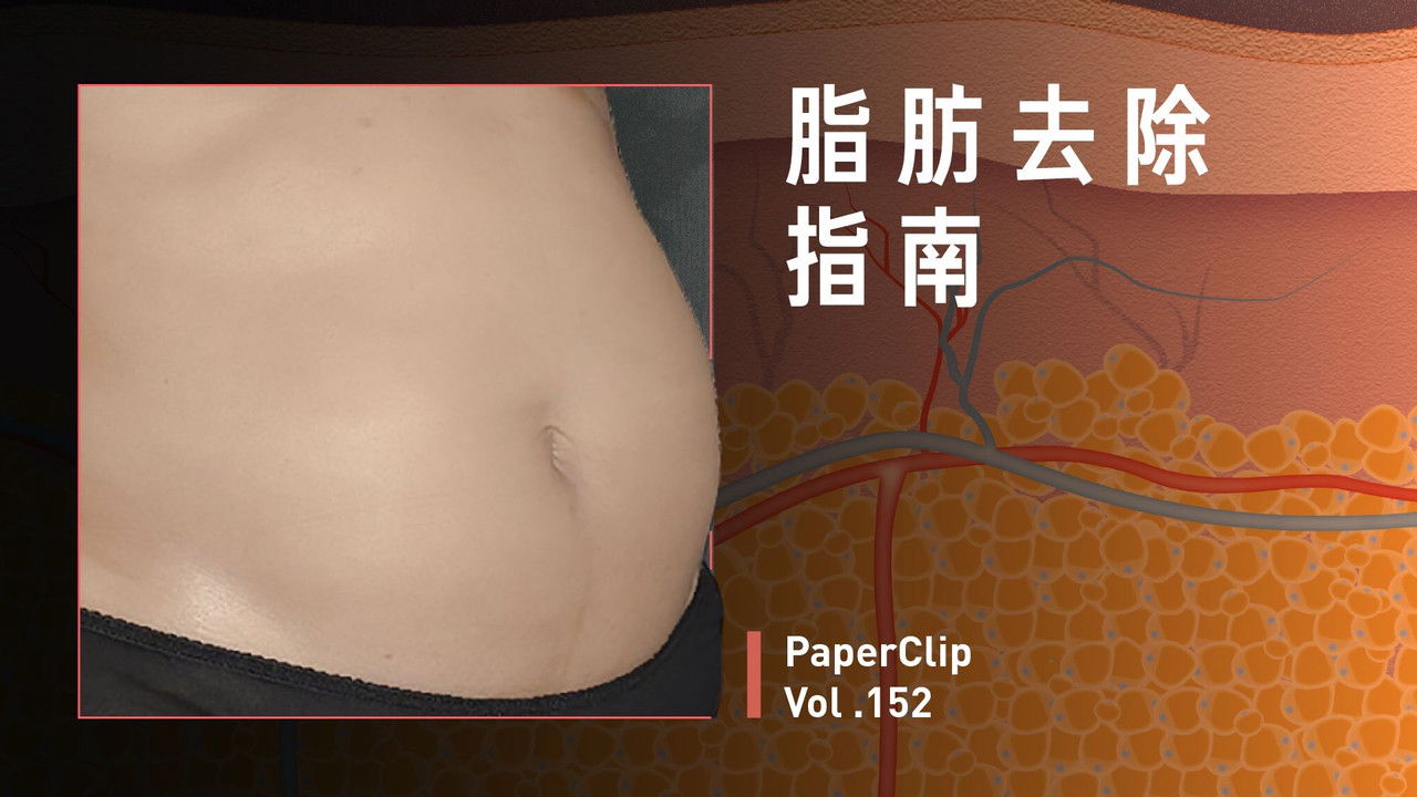 回形针PaperClip — Épisode 152