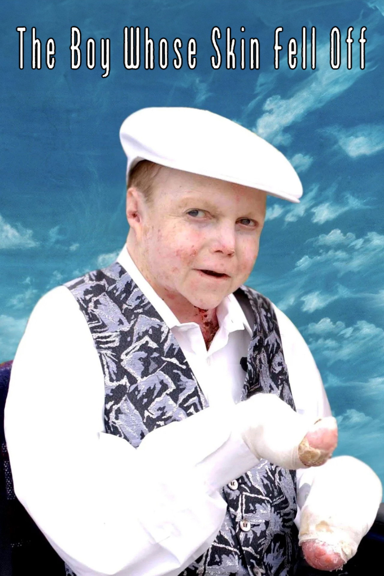 The Boy Whose Skin Fell Off filmaffisch
