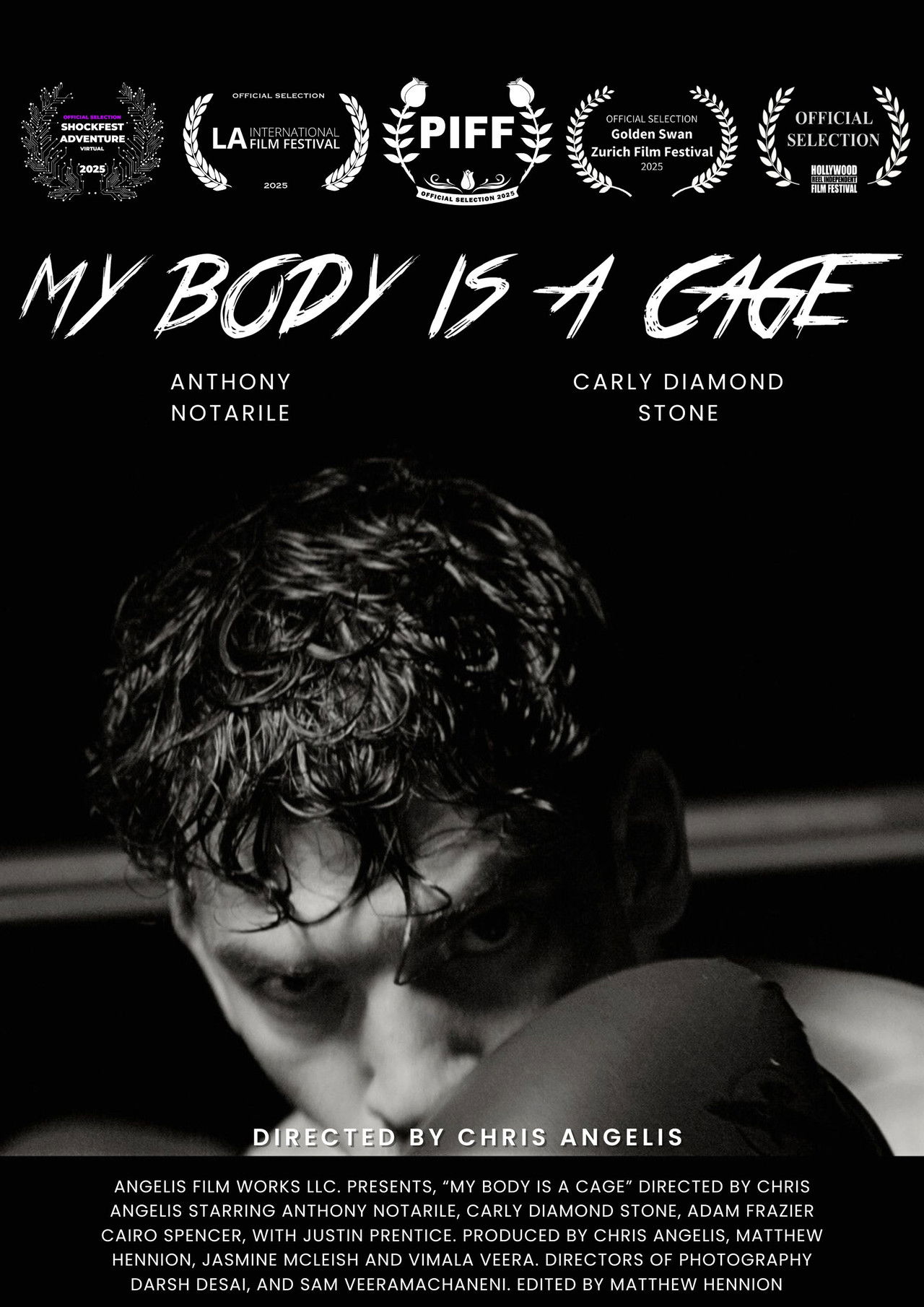 My Body Is A Cage Backdrop