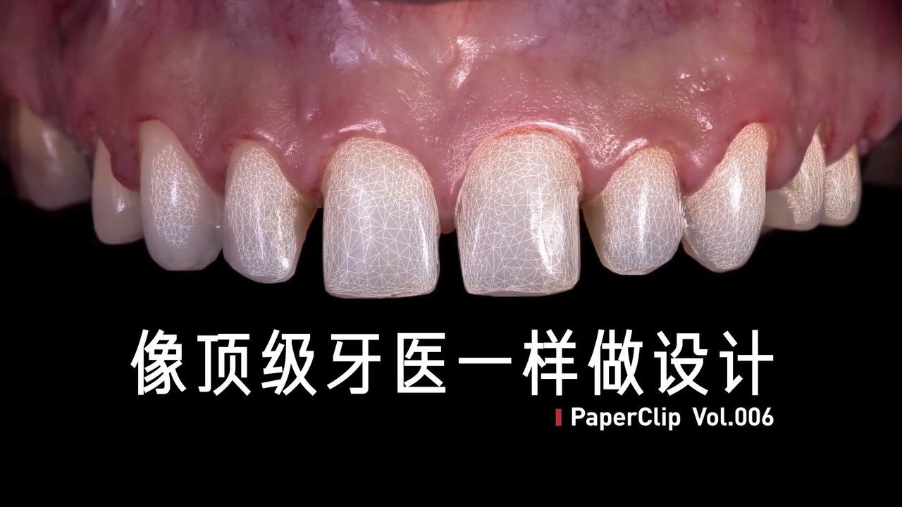 回形针PaperClip — Épisode 6