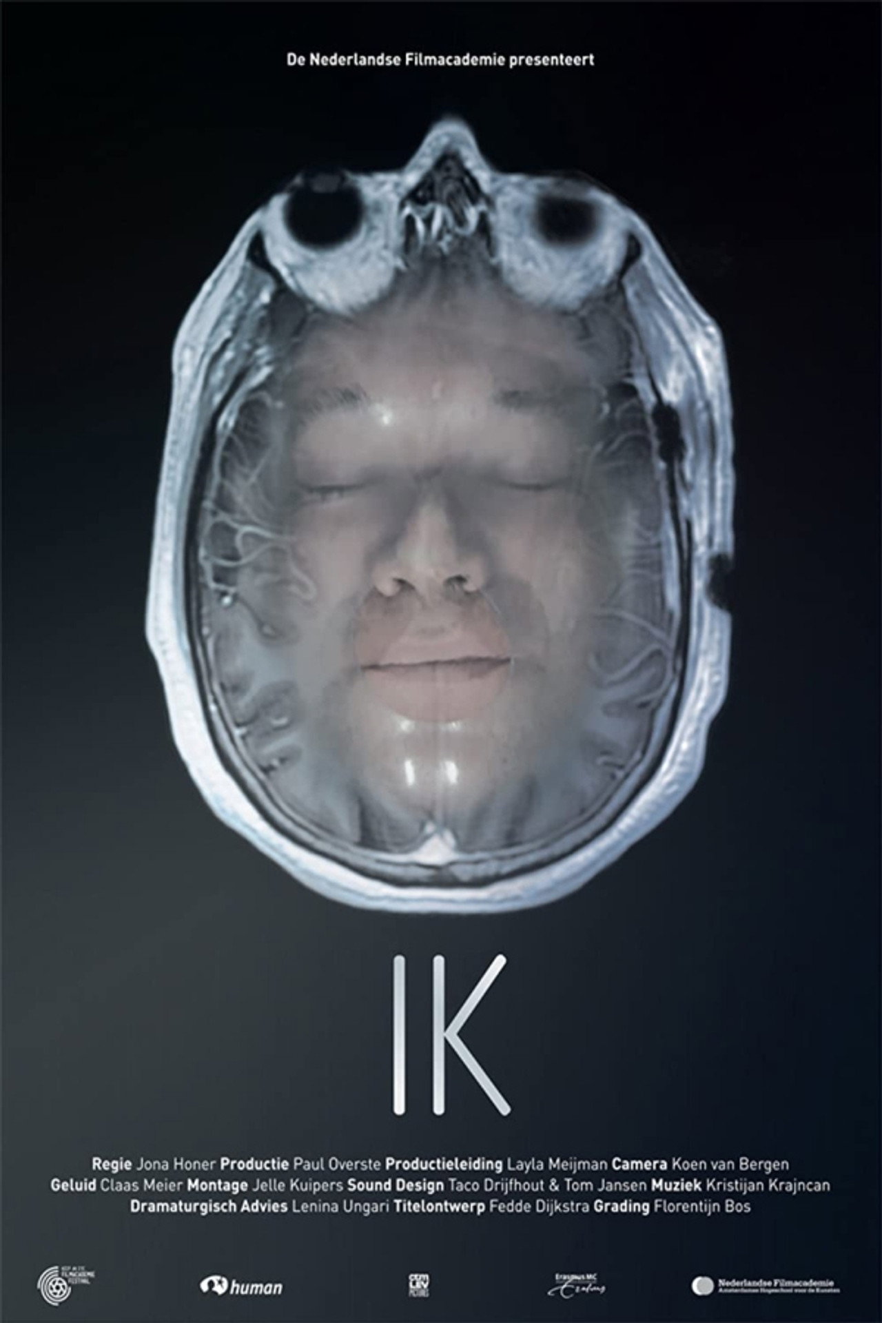 I