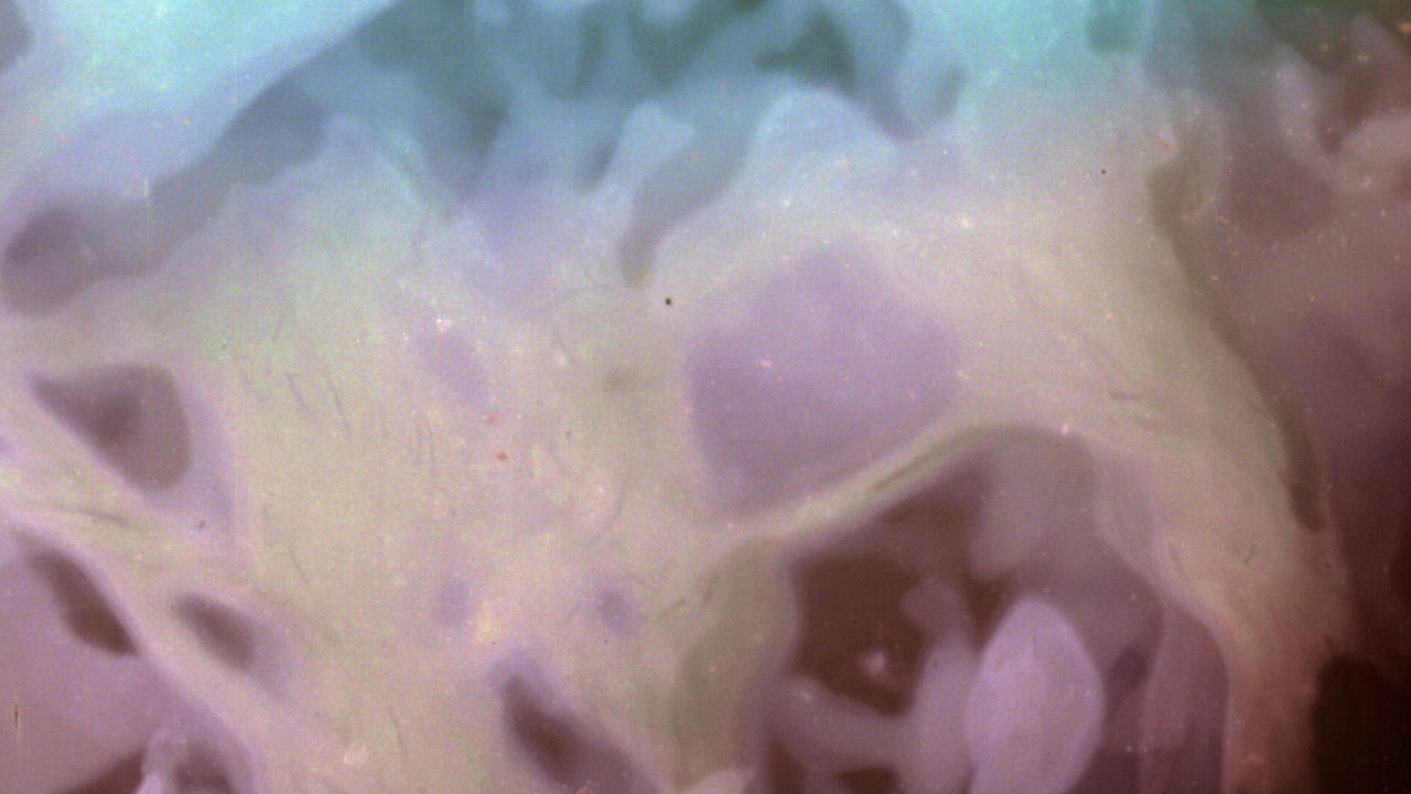 على مرمى حجر