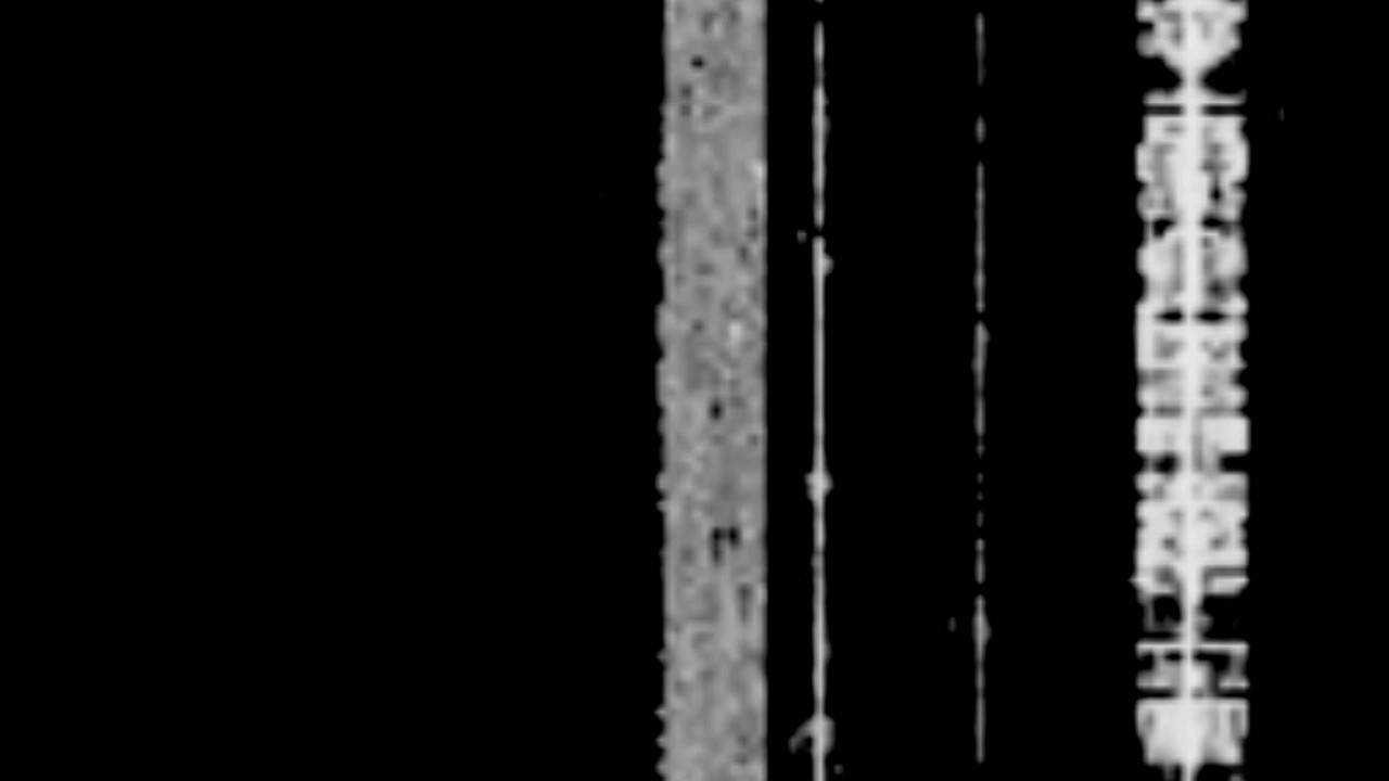Volmet Interference