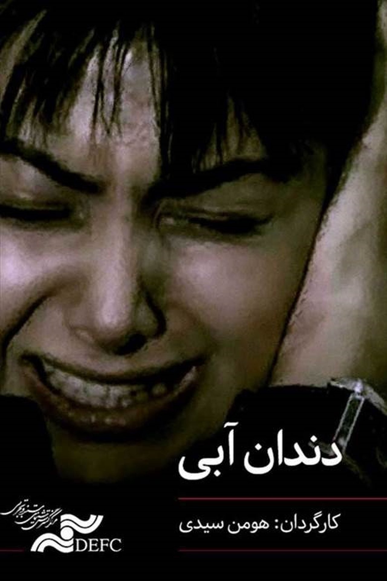 دندان آبی دندان آبی