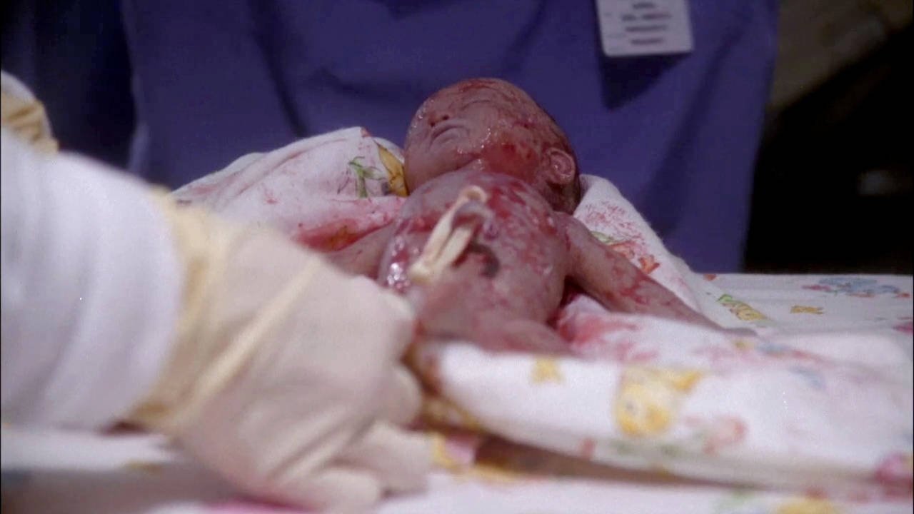 ER - Season 3 Episode 21 : Make a Wish