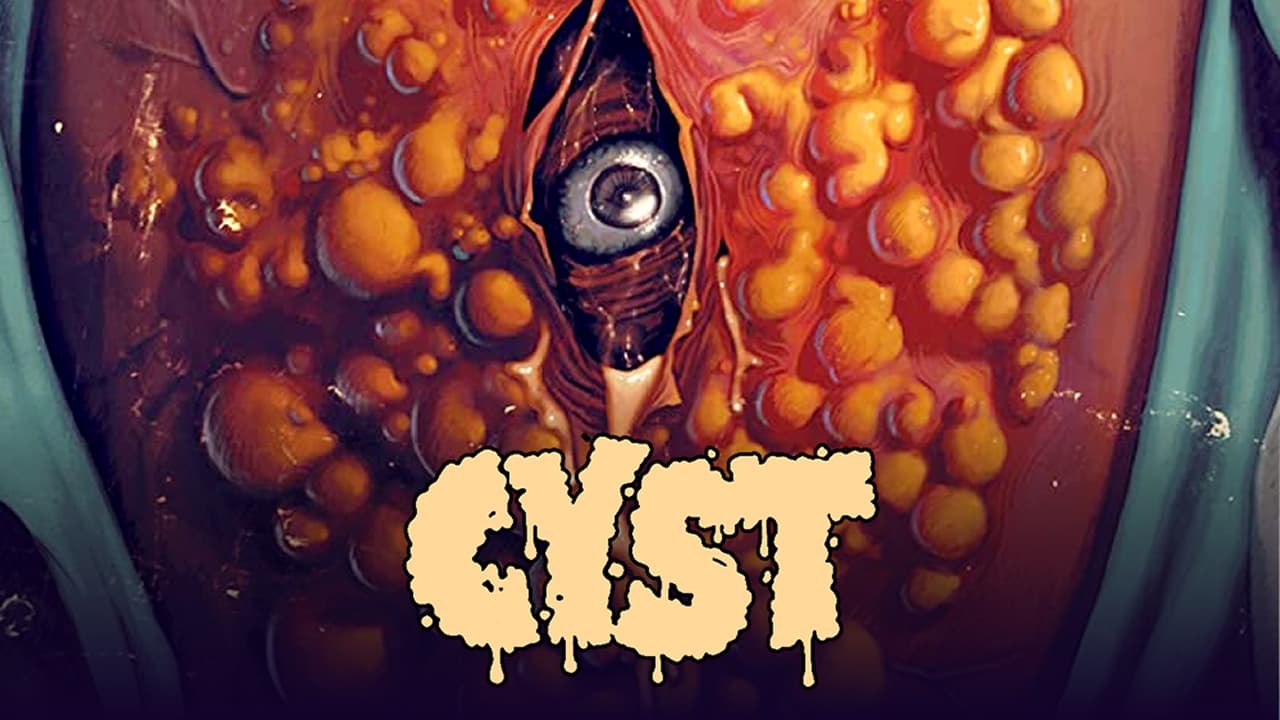 Cyst background