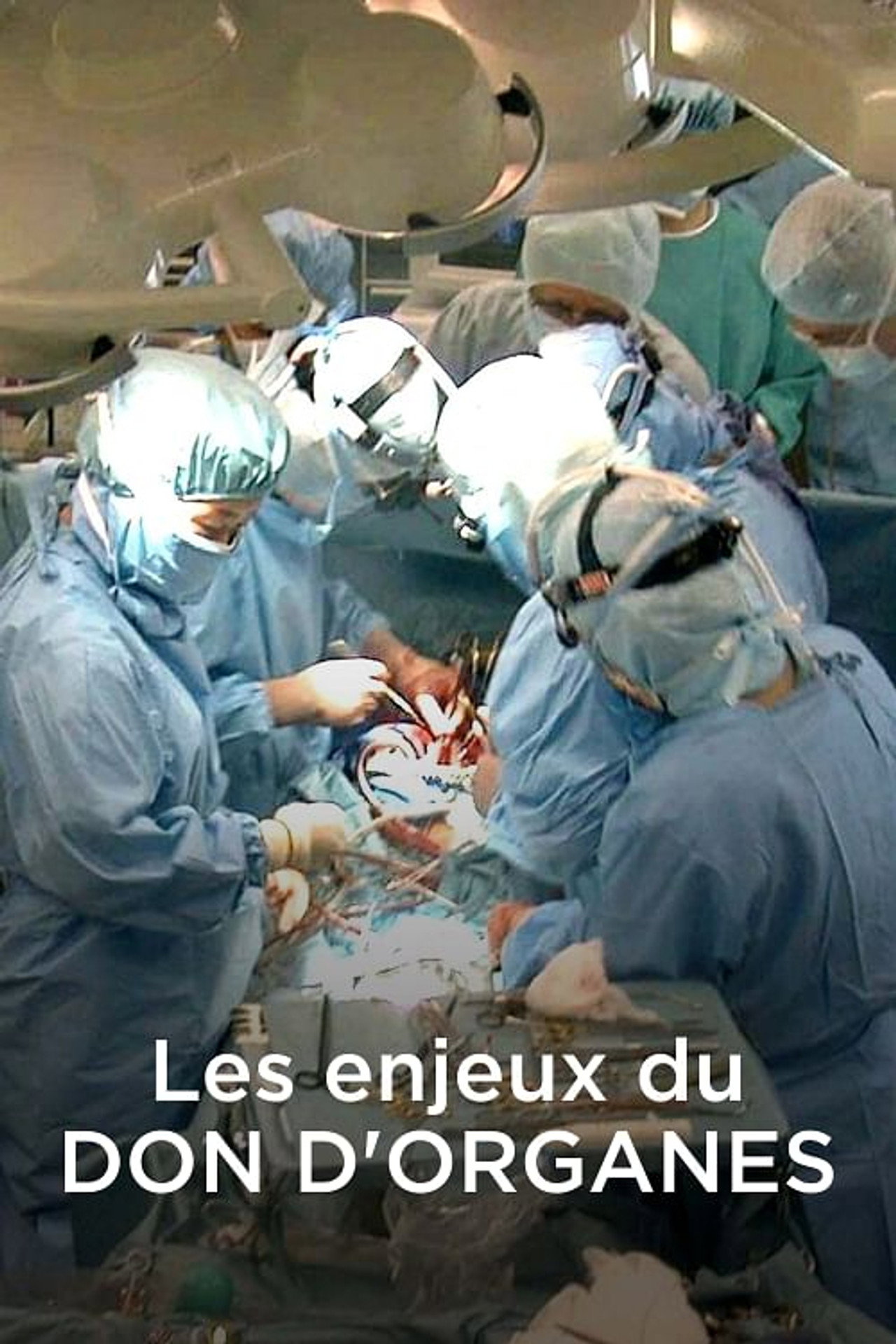 Les Enjeux du don d'organes