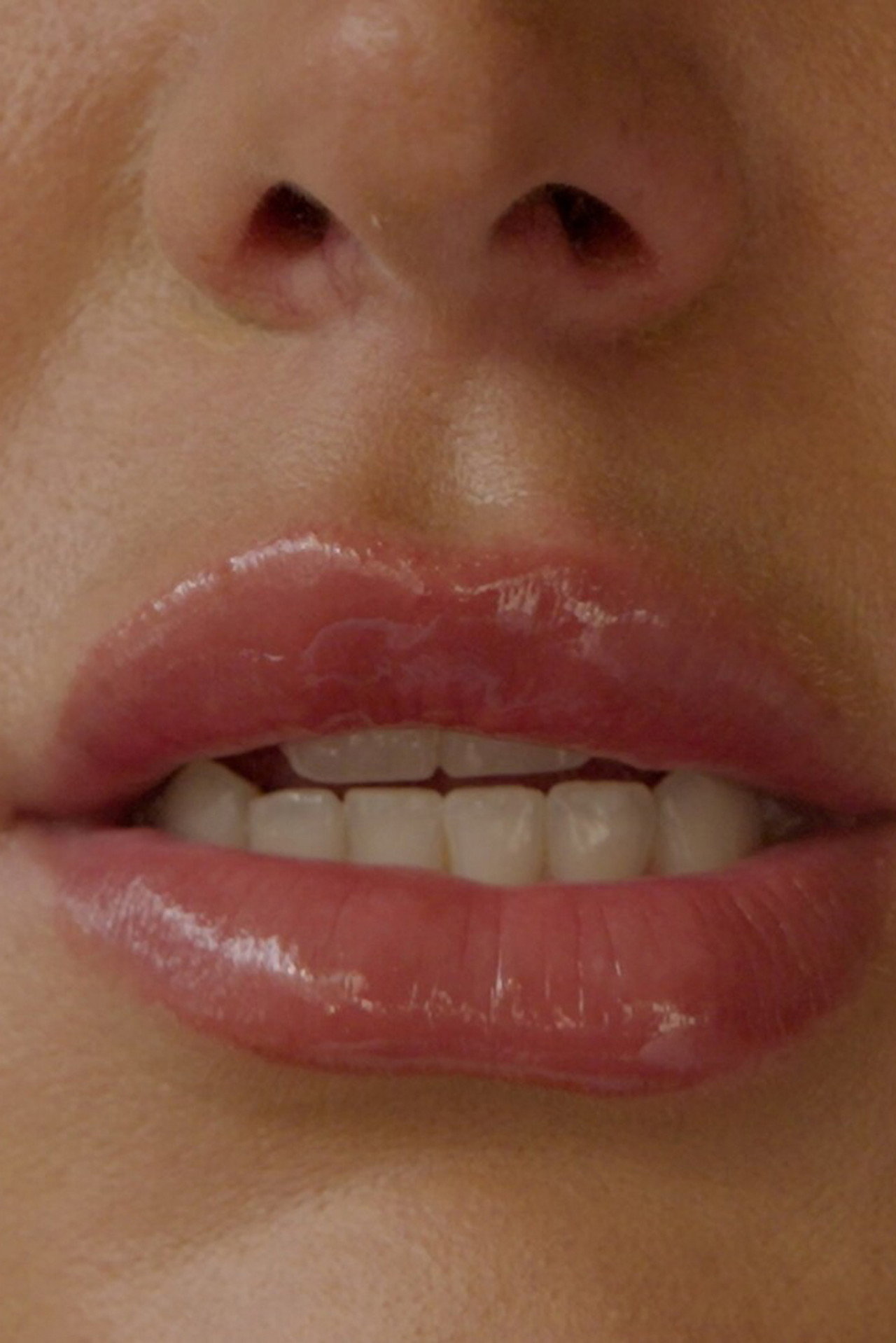 Plumped