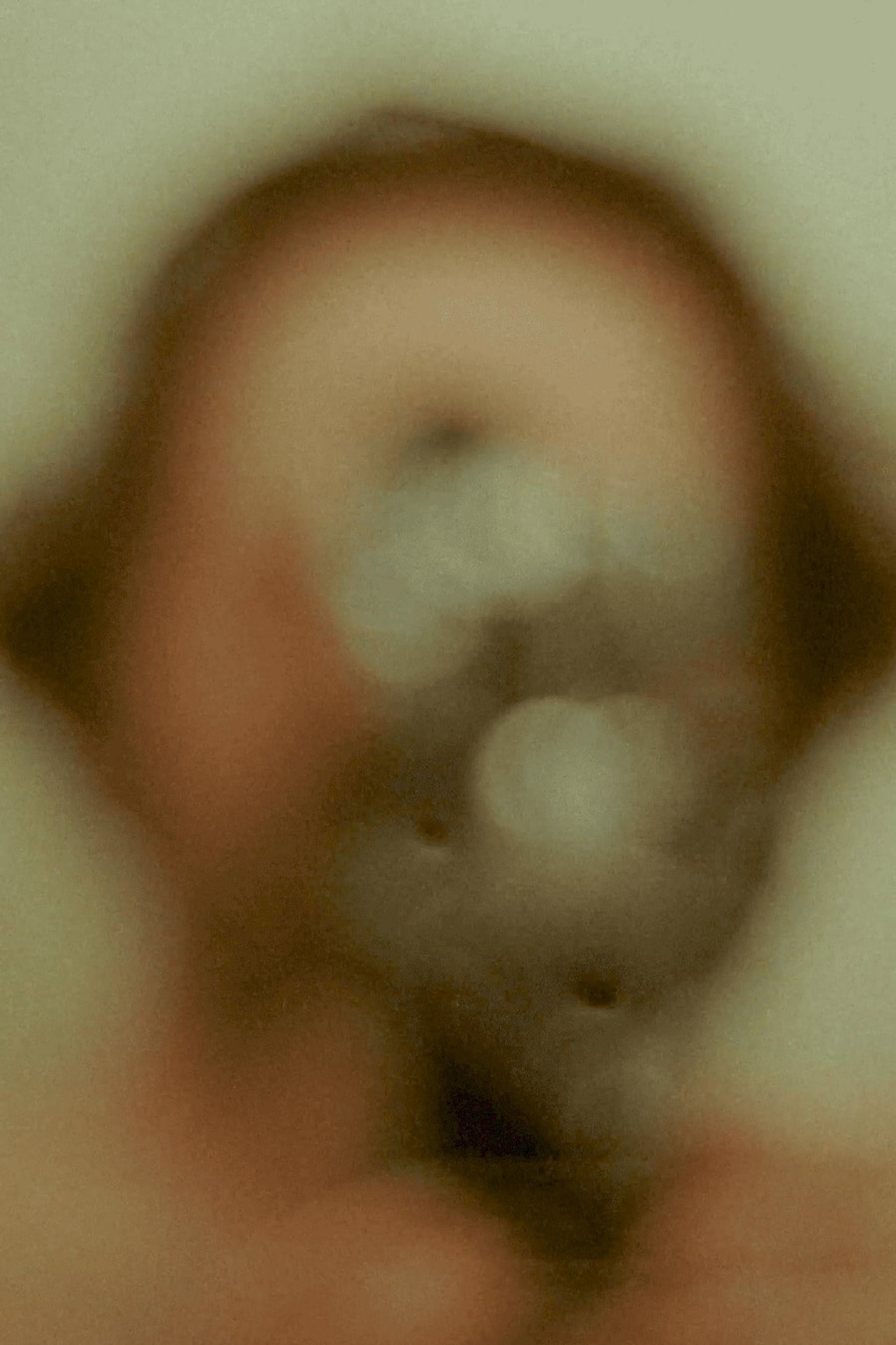 explant / implant