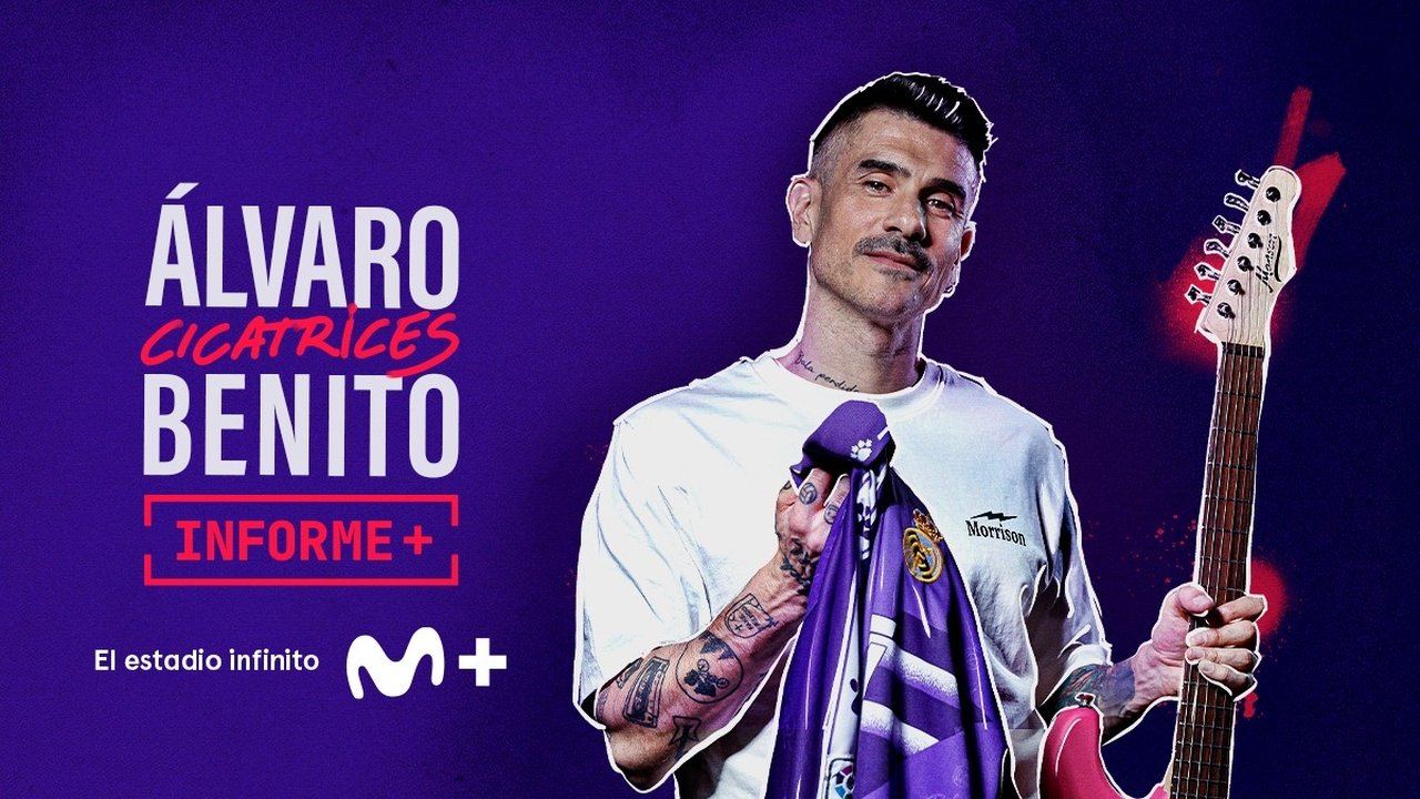 Informe+ - Season 1 Episode 85 : Álvaro Benito. Cicatrices