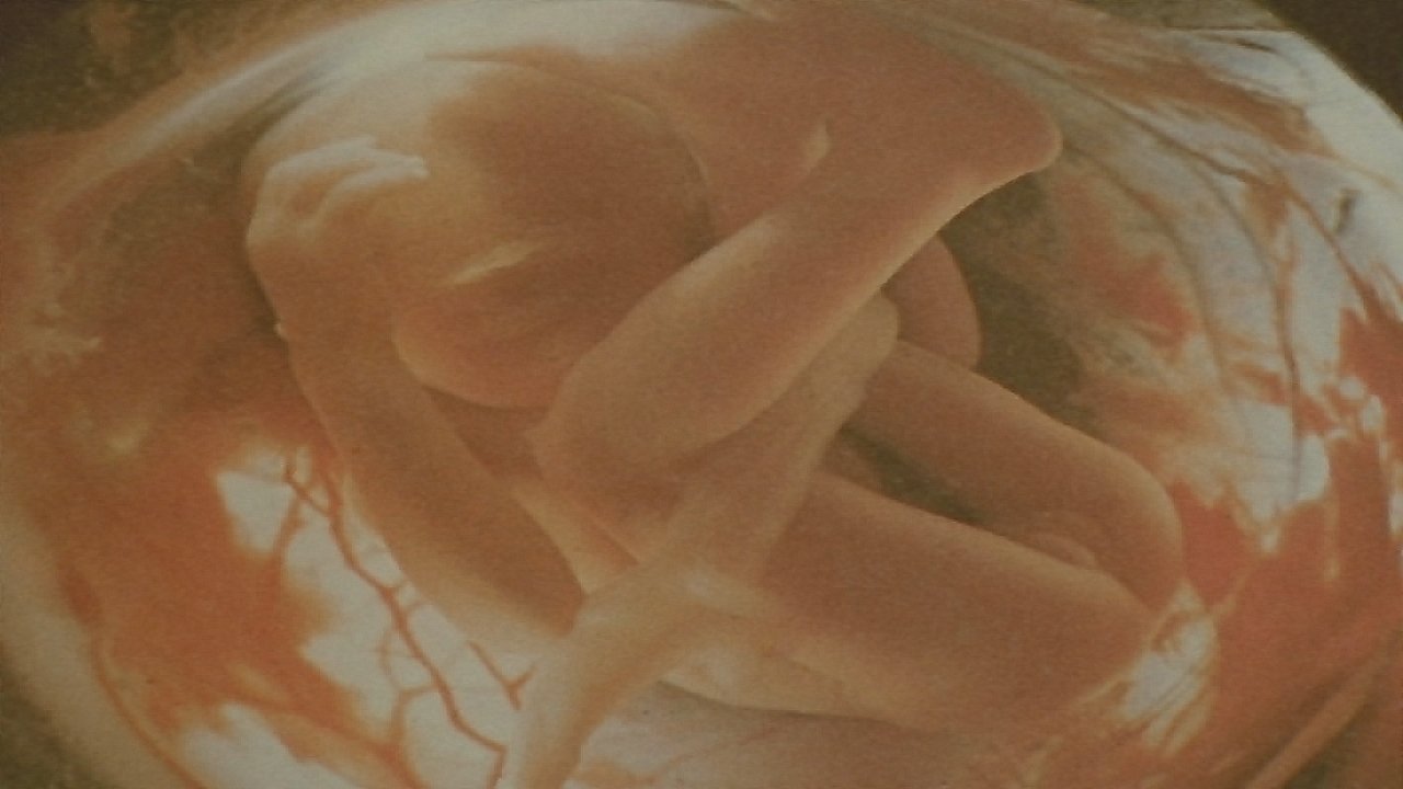 title image