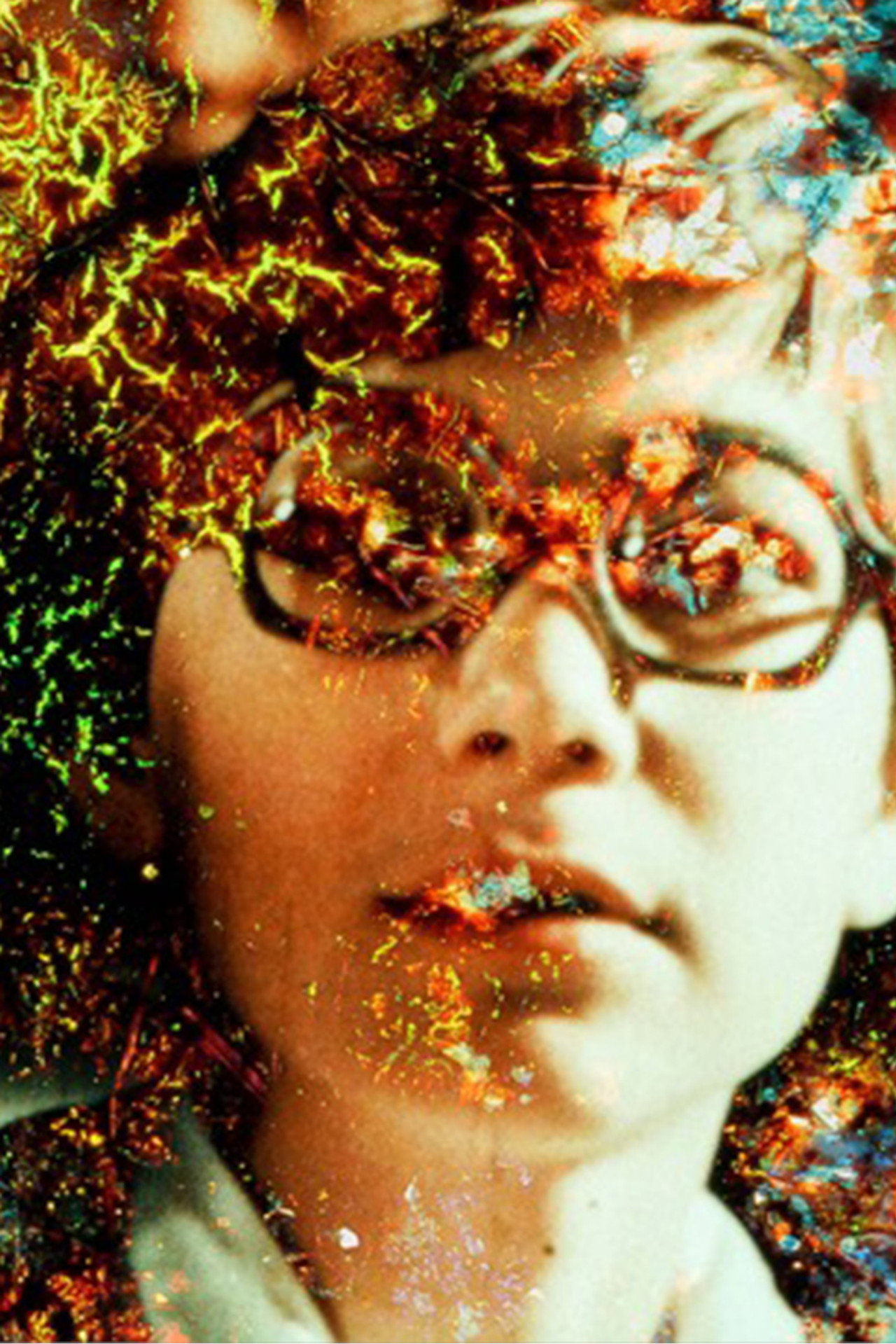 Pigment-Dispersion Syndrome filmaffisch
