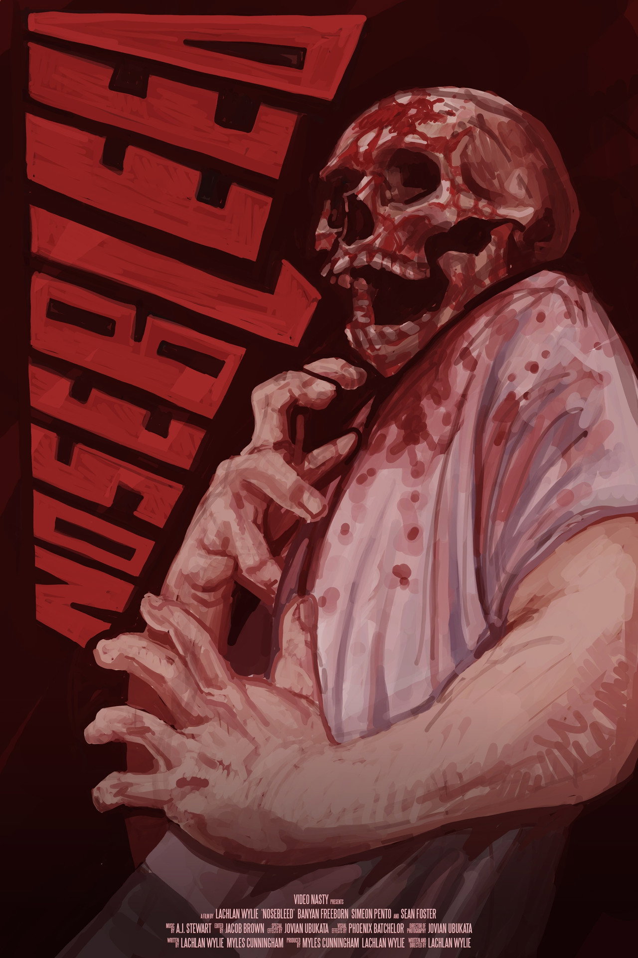 Nosebleed