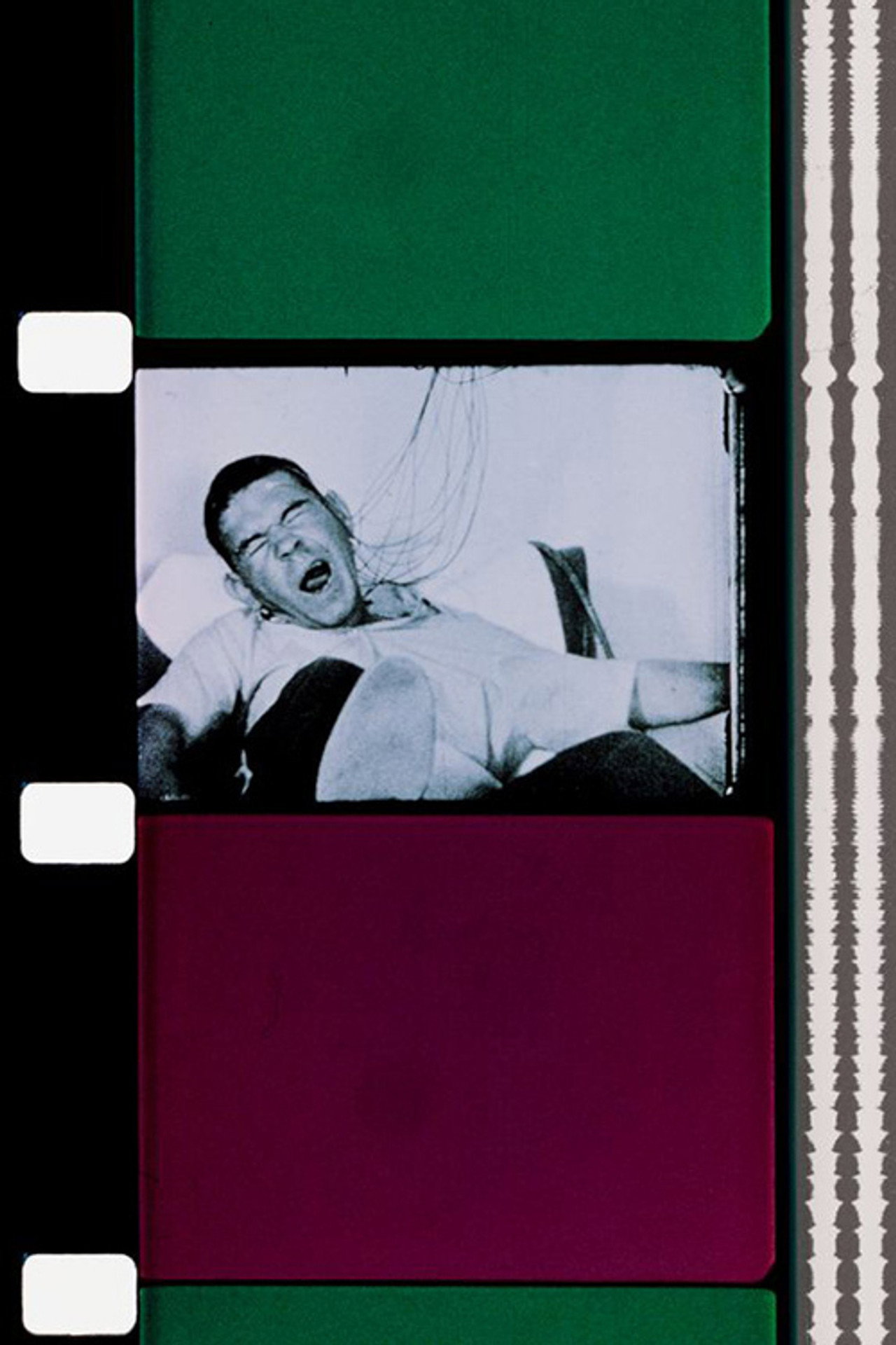 Epileptic Seizure Comparison filmaffisch