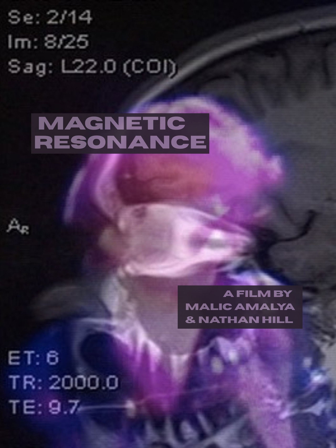 Magnetic Resonance filmaffisch
