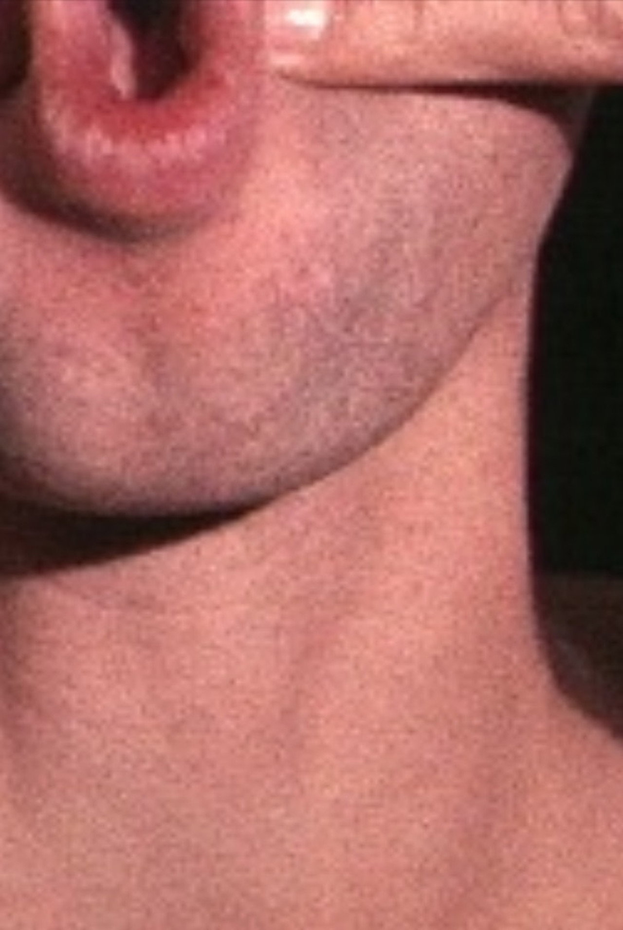 Pinchneck filmaffisch