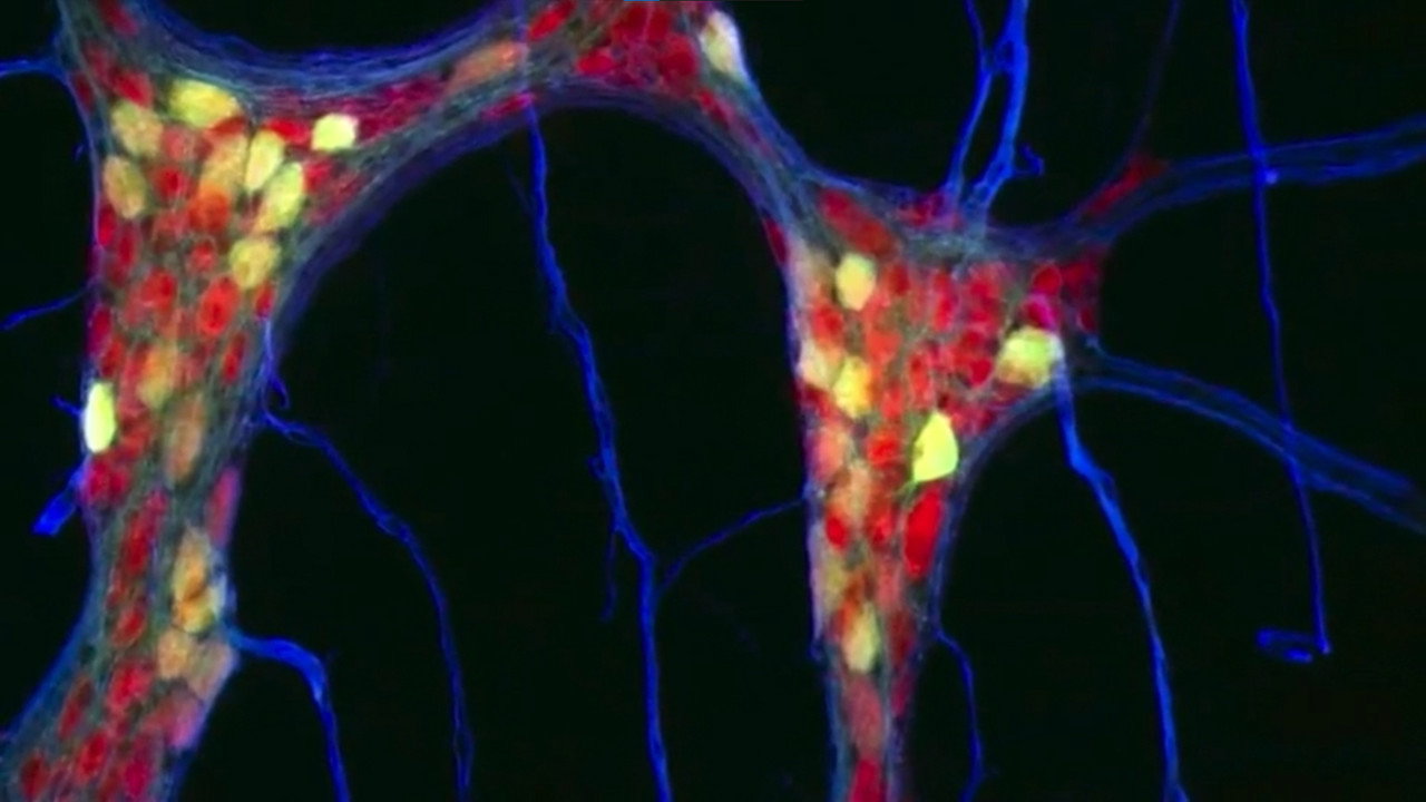 The Gut: Our Second Brain