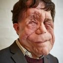 Adam Pearson als The Deformed Man