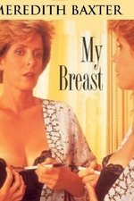 My Breast