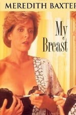 My Breast