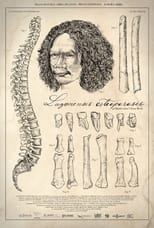 Poster de la película Luzonensis Osteoporosis