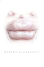 Poster de la película Caterpillarplasty