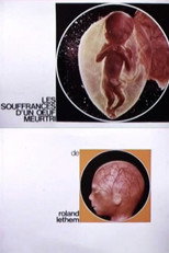 Poster de la película The Sufferings of a Wounded Egg