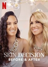 Poster di Skin decision: prima e dopo