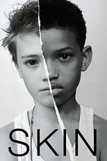 Poster for Skin 