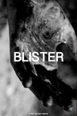 Poster di Blister