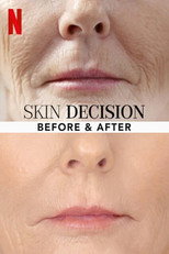 Skin Decision: Before and After (2020)
