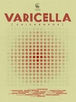 Varicella (2015)