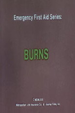 Emergency First Aid Series: Burns poster
