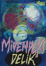 Midemdeki Delik