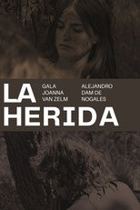 La herida