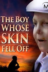 The Boy Whose Skin Fell Off (2004)