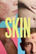 Poster for Skin