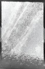 Déplacement des globules de sang dans un vaisseau capillaire