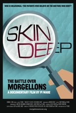 Poster for Skin Deep: The Battle Over Morgellons 