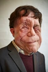 Foto retrato de Adam Pearson