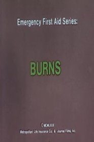 poster Emergency First Aid Series: Burns