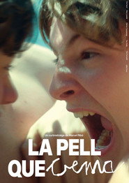 La pell que crema