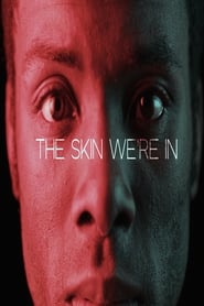 The Skin We're In