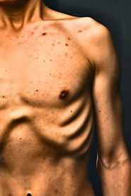 MongoDB.Entities.FuzzyString