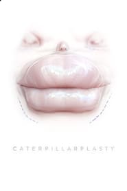 Poster Caterpillarplasty