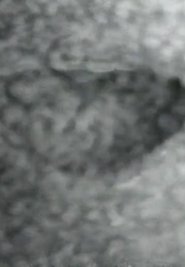 Poster Mouth to Mouth 1975