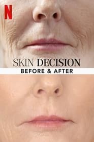 Skin Decision: Before and After постер