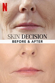Skin Decision: Before and After постер
