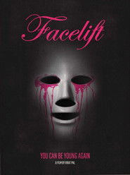 Facelift